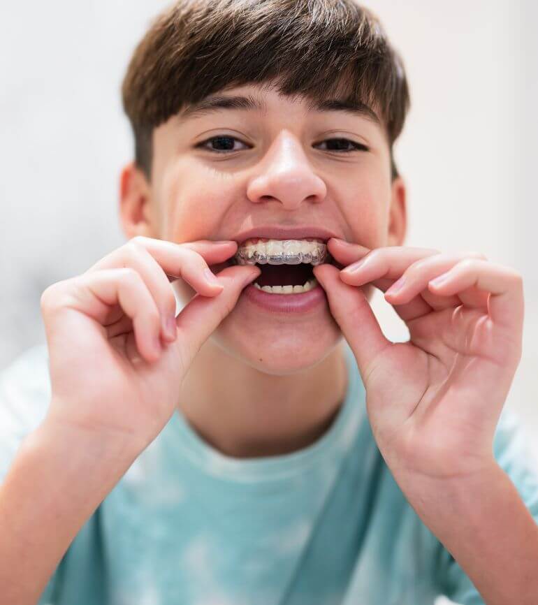 apparecchi invisibili invisalign studio de toni montegrotto terme